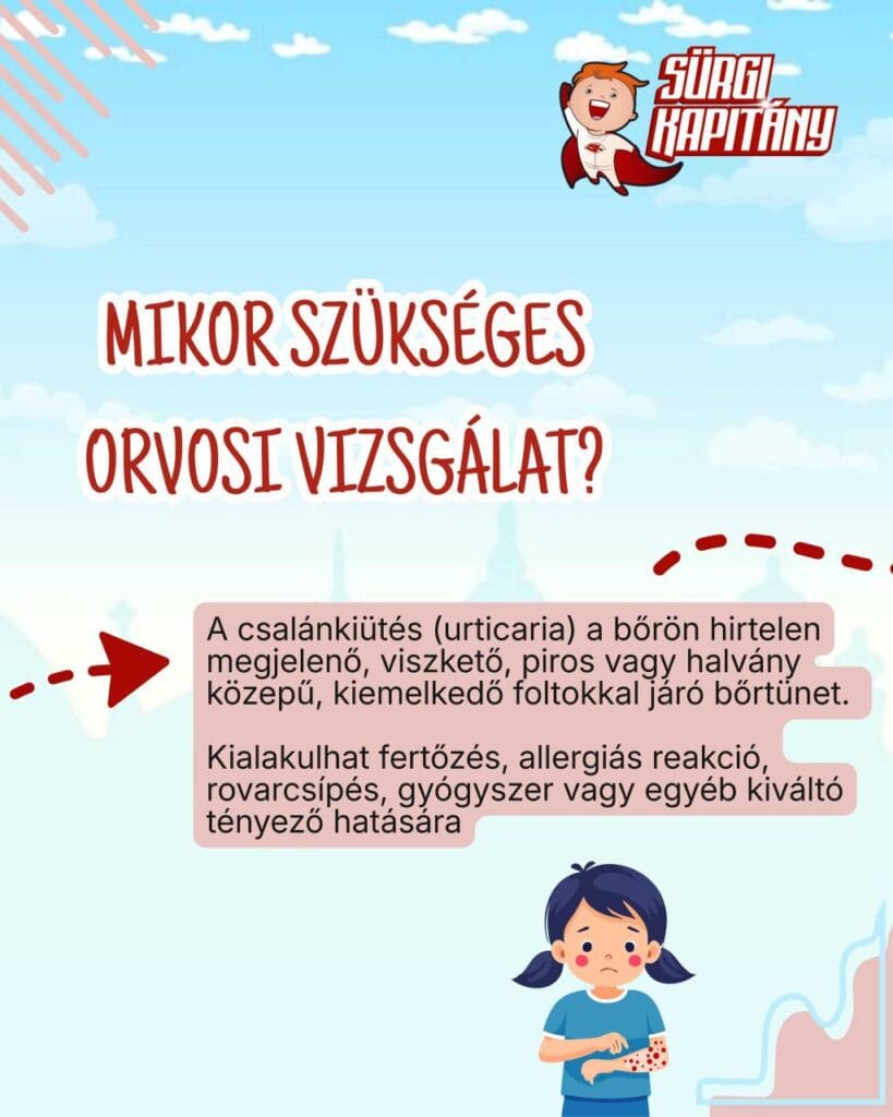Tajekoztato-szüloknek-csalankiütes-orvosi-vizsgalat
