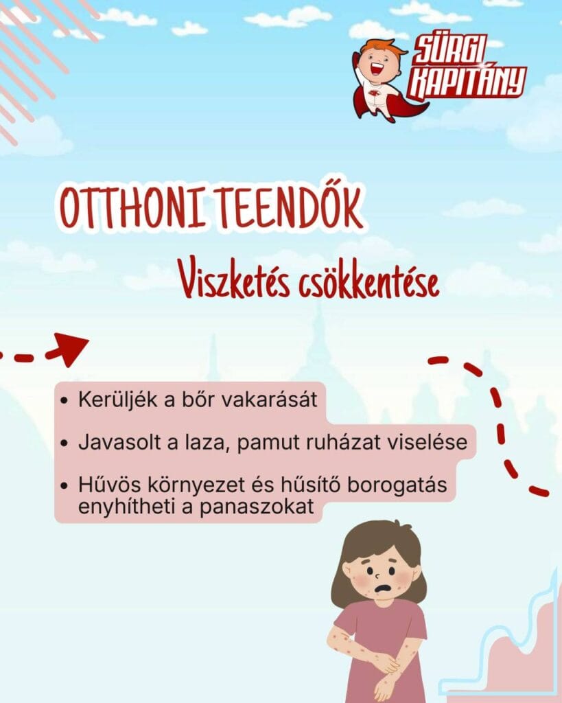 Tajekoztato-szüloknek-csalankiütes-otthoni-teendok